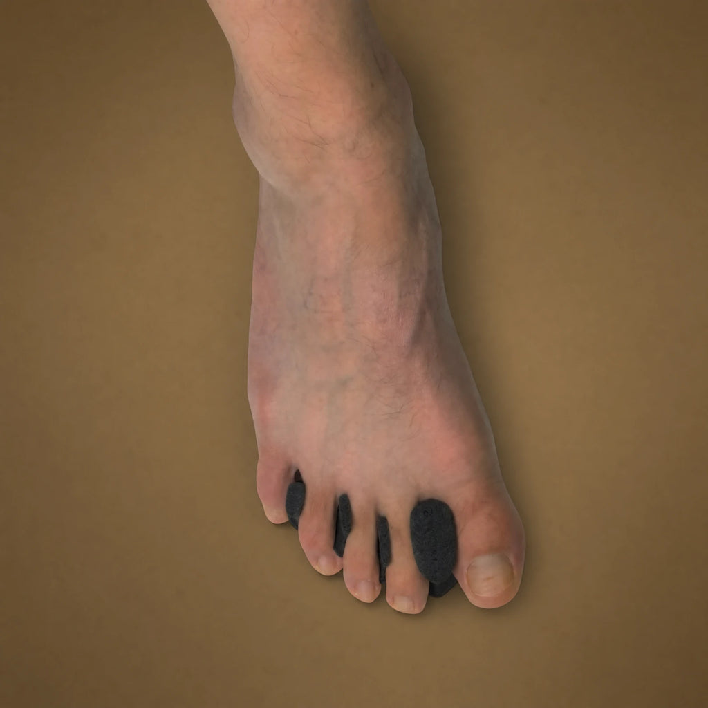3D Custom Toe Spacers worn on foot, showing natural toe splay and alignment
